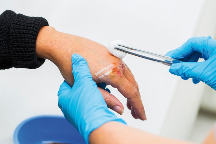 Wound Dressing & Care - Velura Clinic